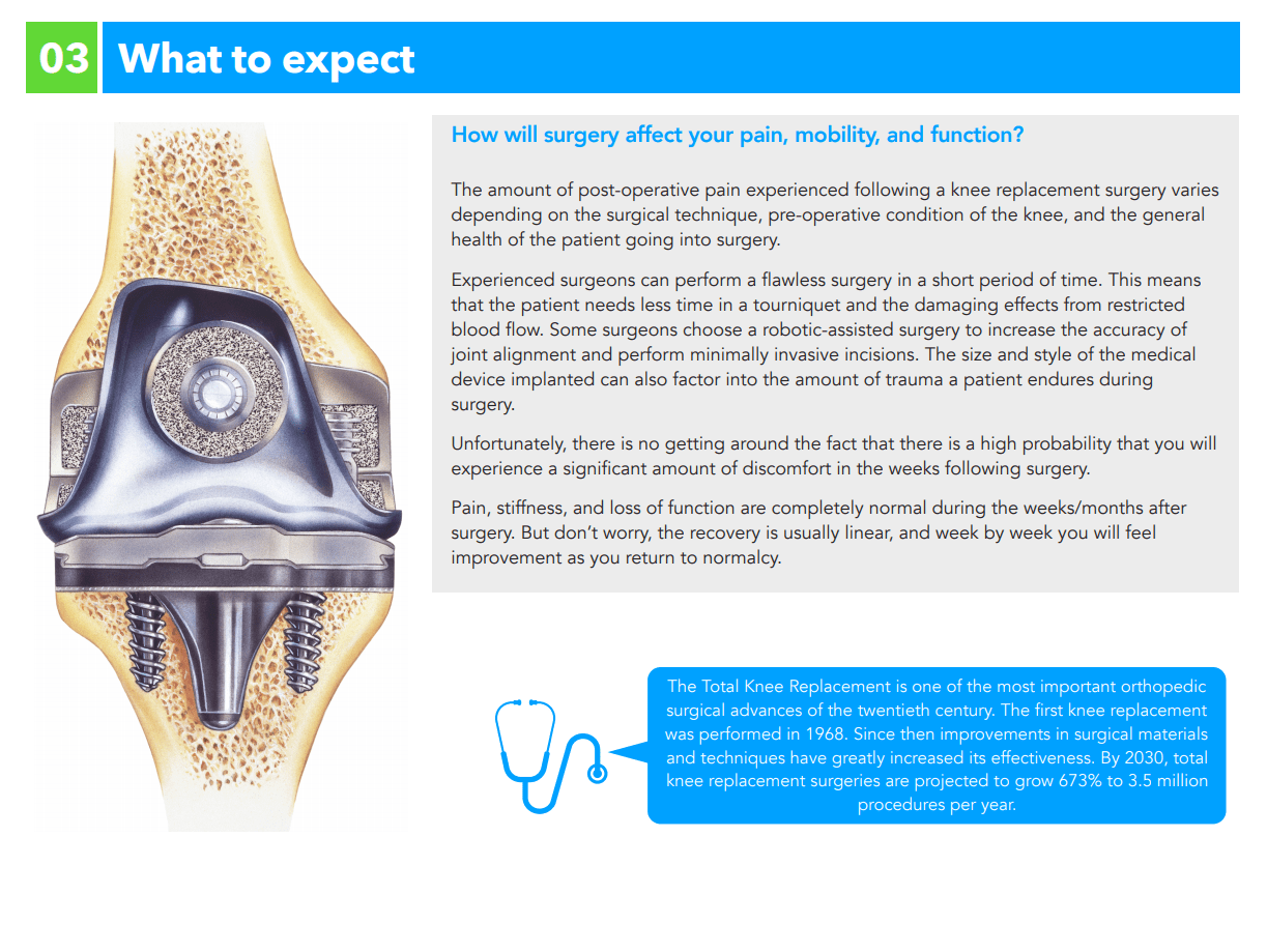 Comprehensive Guide to Knee Replacement Rehab - Total Therapy Florida